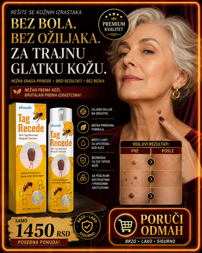Tag Recede – sprej za uklanjanje bradavica 30 ml