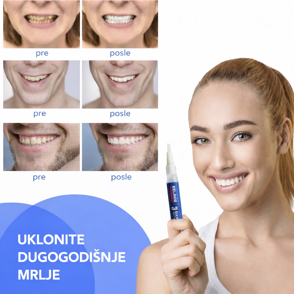 EELHOE olovka za izbeljivanje zuba