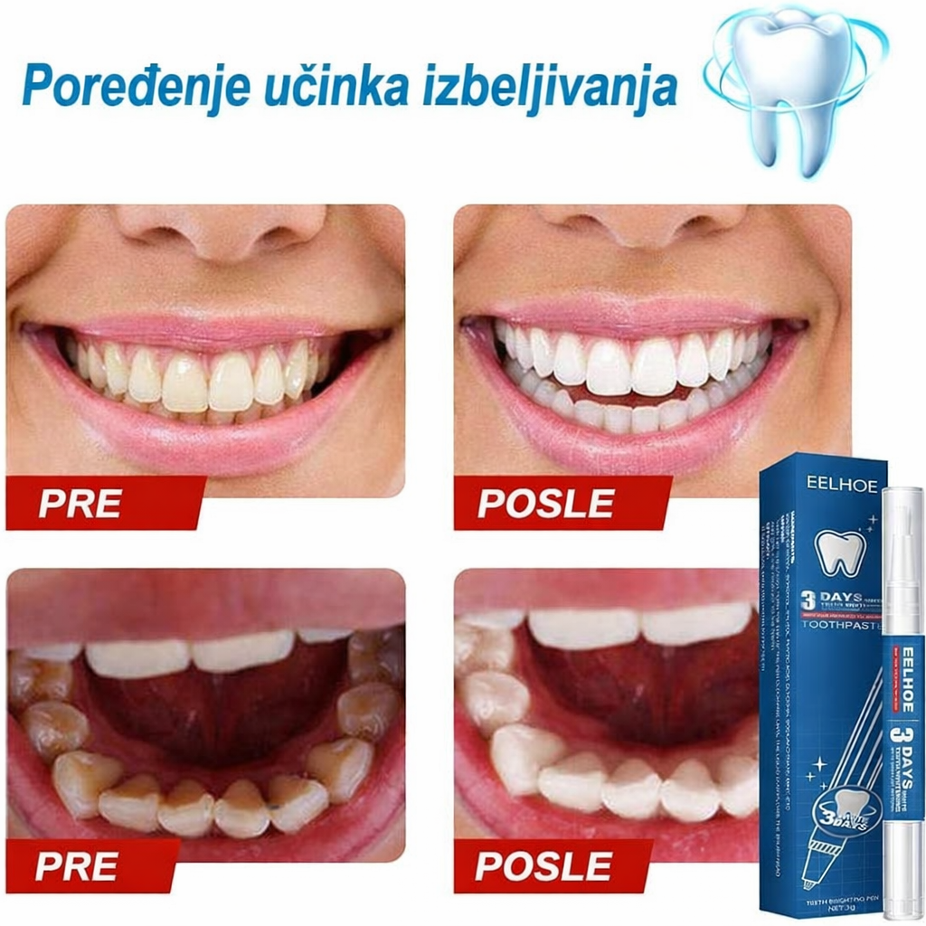 EELHOE olovka za izbeljivanje zuba