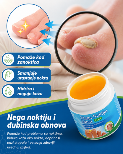1+1 Gratis Nail Fungus Ointment PLUS – mast za negu noktiju i kože oko noktiju