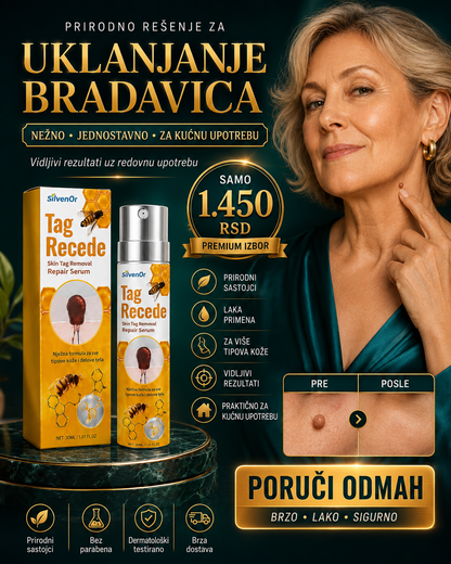 Tag Recede – sprej za uklanjanje bradavica 30 ml