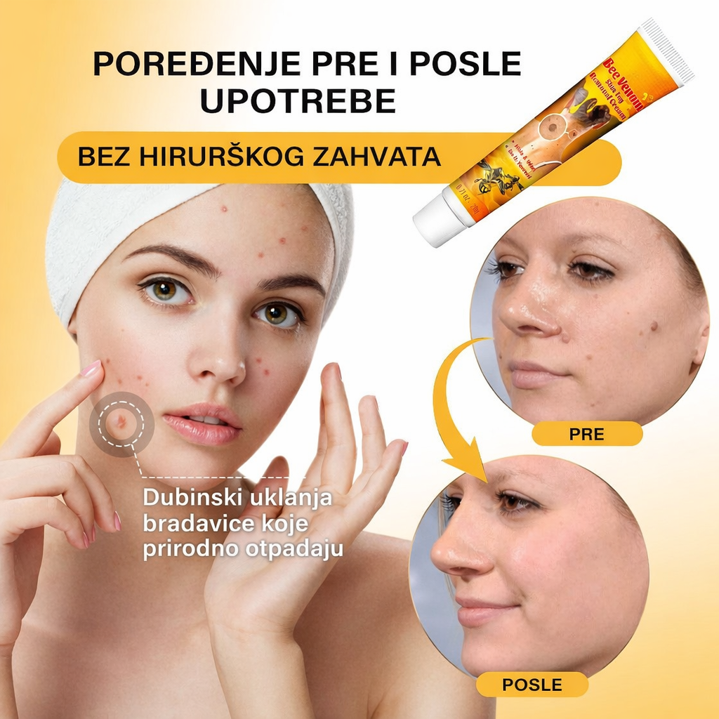 Krema sa pčelinjim otrovom protiv fleka i hiperpigmentacije 1+1 Gratis