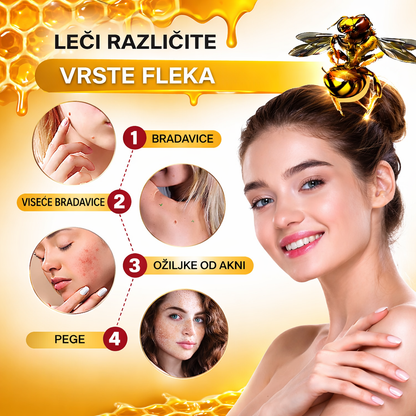 Krema sa pčelinjim otrovom protiv fleka i hiperpigmentacije 1+1 Gratis